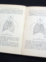 War Injuries of the Chest